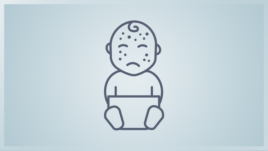 Icon eines Babys mit Pocken.